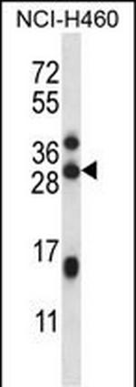 METTL23 Polyclonal Antibody