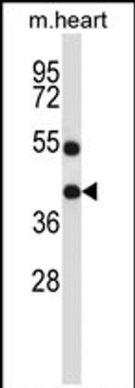 DTX3 Antibody in Western Blot (WB)