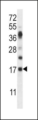 RNASE6 Polyclonal Antibody