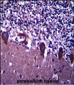 TLE6 Polyclonal Antibody