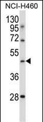 TLE6 Antibody in Western Blot (WB)
