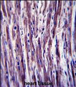 HACD1 Polyclonal Antibody