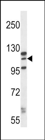 MORC1 Antibody in Western Blot (WB)