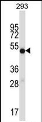 IMPDH1 Antibody in Western Blot (WB)