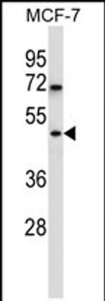 WDR88 Antibody in Western Blot (WB)