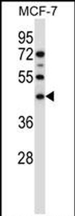 SGMS1 Antibody in Western Blot (WB)
