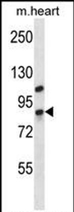 DHX32 Antibody in Western Blot (WB)