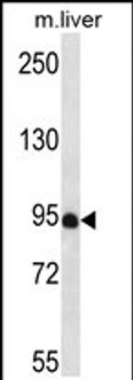 PDZD4 Antibody in Western Blot (WB)