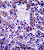 UBE2W Polyclonal Antibody
