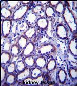 TRIM34 Antibody in Immunohistochemistry (IHC)