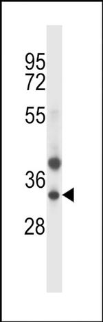 TRIM34 Antibody in Western Blot (WB)