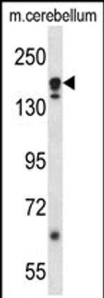 ATG2A Antibody in Western Blot (WB)
