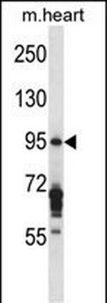 EXOC6B Polyclonal Antibody