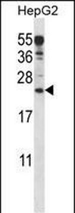 ANKRD22 Antibody in Western Blot (WB)