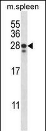 ANKRD22 Antibody in Western Blot (WB)