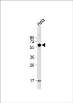 SMOC1 Antibody in Western Blot (WB)
