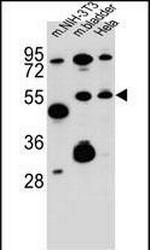 SMOC1 Polyclonal Antibody