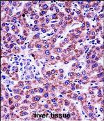 GYPB Polyclonal Antibody