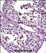 CTAG2 Polyclonal Antibody