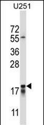 CTAG2 Antibody in Western Blot (WB)