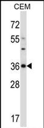 CDK3 Antibody in Western Blot (WB)