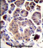 TRIM36 Antibody in Immunohistochemistry (IHC)
