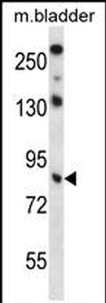 TRIM36 Antibody in Western Blot (WB)