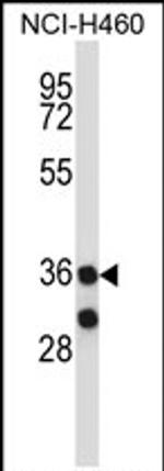 MARCH11 Antibody in Western Blot (WB)