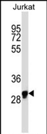 OR1N1 Antibody in Western Blot (WB)