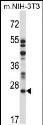 LAPTM4A Antibody in Western Blot (WB)