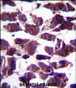 LRIG2 Polyclonal Antibody