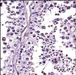 Relaxin 1/2 Polyclonal Antibody