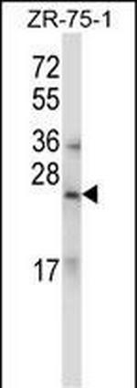 Relaxin 1/2 Antibody in Western Blot (WB)
