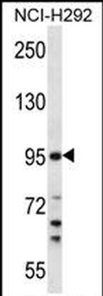 TMPRSS7 Antibody in Western Blot (WB)