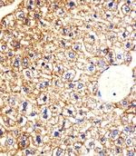 CK1 gamma Antibody in Immunohistochemistry (Paraffin) (IHC (P))
