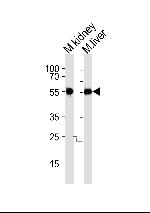 CK1 gamma Antibody in Western Blot (WB)