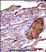 MEKK2 Antibody in Immunohistochemistry (IHC)