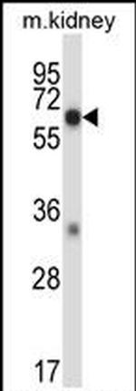 MEKK2 Antibody in Western Blot (WB)