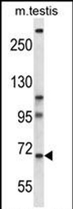 PAN3 Antibody in Western Blot (WB)