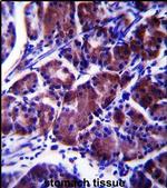 LYPLAL1 Antibody in Immunohistochemistry (IHC)