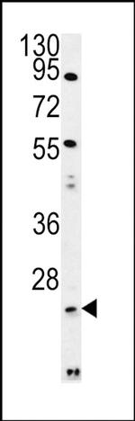 LYPLAL1 Antibody in Western Blot (WB)
