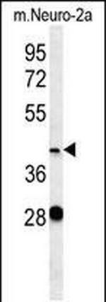 VASH2 Polyclonal Antibody