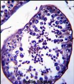 SPATA18 Antibody in Immunohistochemistry (IHC)