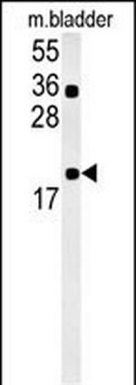 CCDC12 Polyclonal Antibody