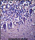 LRRC8B Antibody in Immunohistochemistry (IHC)