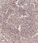 CD163L1 Antibody in Immunohistochemistry (Paraffin) (IHC (P))