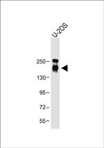 CD163L1 Antibody in Western Blot (WB)