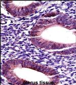 MMP17 Antibody in Immunohistochemistry (IHC)