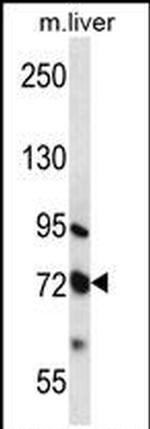 MMP17 Antibody in Western Blot (WB)
