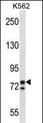 PCSK7 Antibody in Western Blot (WB)
